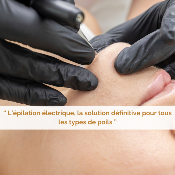 Réduction du mois